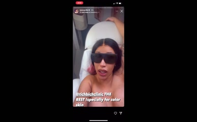 Cardi B Laser Hair Removal Topless