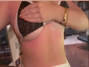 Saffron Barker's Sunburned Tits