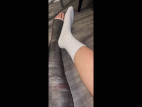 Man's Full Leg Cast and Bare Foot.