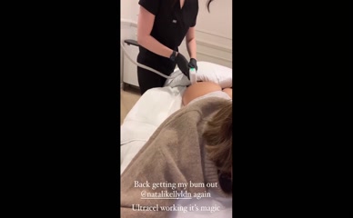Frankie Bridge Butt Lift Treatment