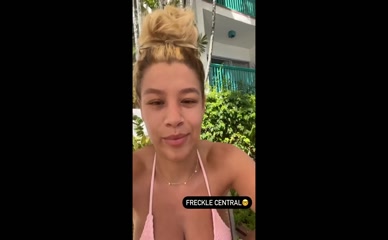 Molly Rainford freckle bikini tease