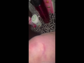 the.lumi.baby's Bruised and Scraped Legs