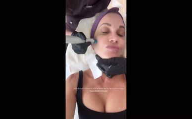 Ashley Roberts Hydrafacial