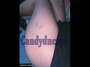  alt="Candyducepe"