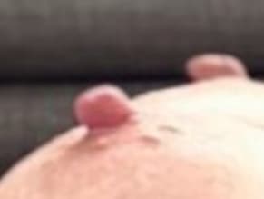 Zart Prickelnd
