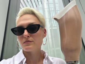 Hollyshaleramputee