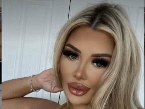 Scar_Doll
