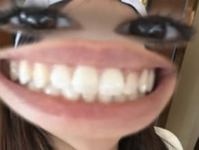 Alanalarana