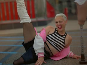 Hollyshaleramputee