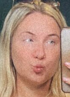 JE_FRECKLES