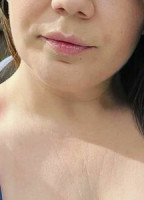 MS_HEIDI