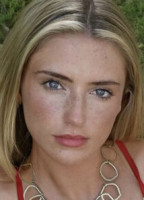 EMMA BURNZE