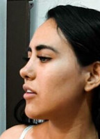 IMLIZETH