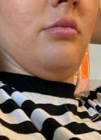 LILYLEMONX