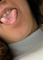 TAERAPFREE