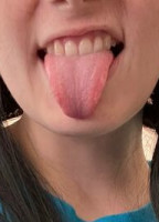 HNNNYY
