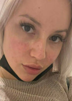 THEREALKYLIEPAGE