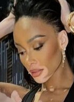 WINNIE HARLOW NUDE