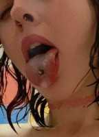 ANEMIAA