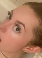 GINGERFRECKLESFREE