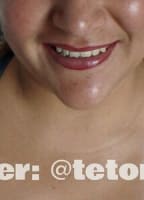 SUPERTETAS
