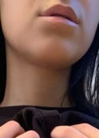 EMXLYY