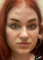 ALBINOTEEN