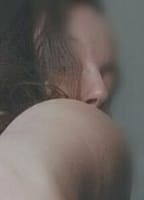 AMYROSELEAL