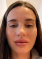 ANNA1111