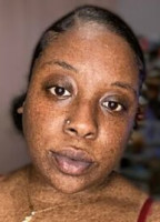 FRECKLEDFANTASY