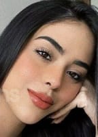 GEMELAS ABELLO NUDE