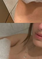 OHLALANORTHFREE