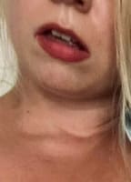 PINJAXXFREE
