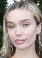 RARA KNUPPS