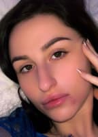 ABELLA4UX