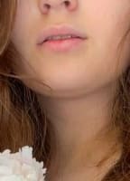 IVYNAKED1