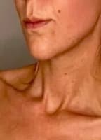 LINDOLIVIA