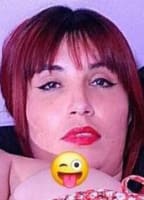 NOVACAYNEXXX