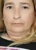 TRANSCHICK