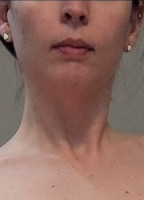 TIMIDLILYGIRL