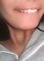 CHERRYGIA