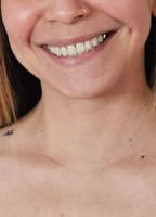 AMELIATHEM1LFFREE