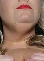 MIDWESTBREASTS