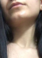 LISETTE