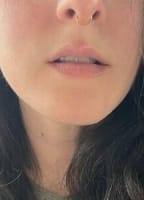 ADAALLUREFREE NUDE