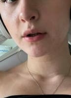 MORGENKONDENAR NUDE