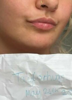 TAYLORHUGS