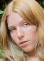 DOYOULIKEFRECKLES