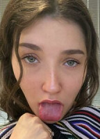 AJXRAY