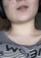 TWINKYDIONEFREE